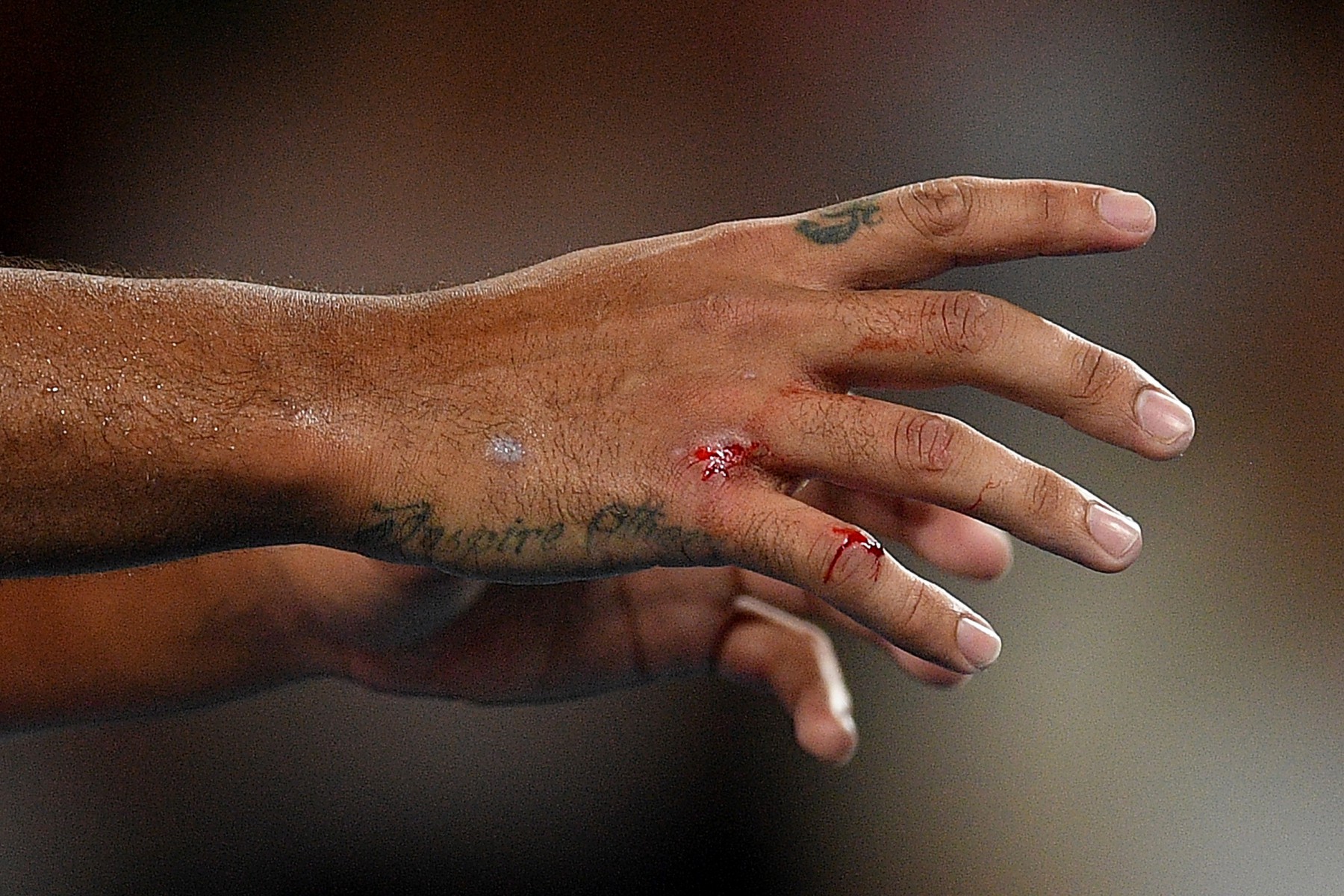 Kyrgios took his fair share of tumbles across the court in Melbourne, cutting open his hand