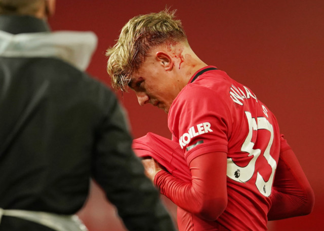, Man Utd star Brandon Williams left with bloodied face after horror clash of heads as fans brand him ‘f***ing warrior’