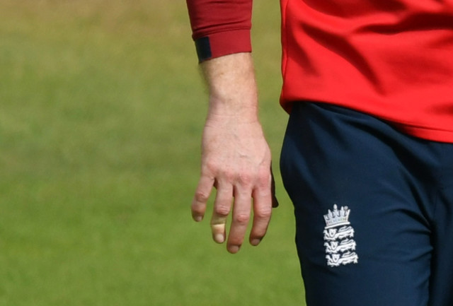, England captain Eoin Morgan forced to pop dislocated finger back in against Australia live on BBC… then plays on