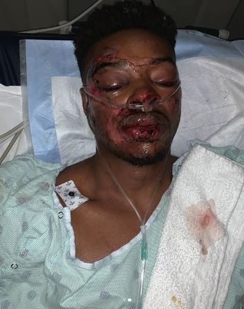 , Errol Spence Jr shows off horrific facial injuries in hospital bed year after near-fatal high-speed car crash