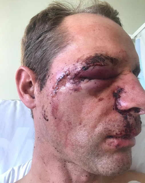 , Jockey Danny Cook fighting to save eyesight and career after needing 50 stitches to his face when kicked by horse