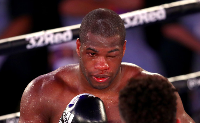 , Daniel Dubois out for five months with cracked eye socket and bleed on retina with Brit narrowly escaping being BLINDED