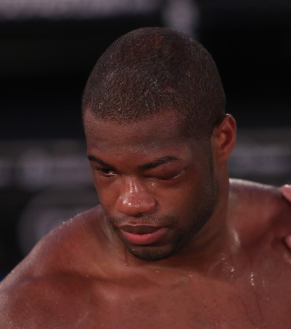 , Daniel Dubois should watch greats like Muhammad Ali and Ken Buchanan to see why he is being dubbed a ‘quitter’