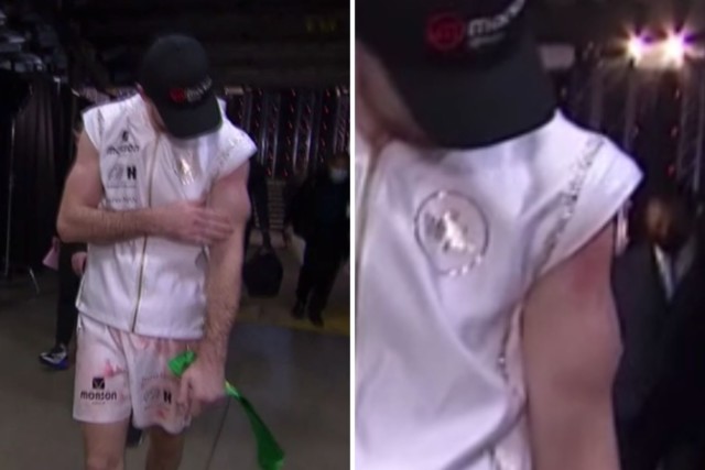 , Callum Smith left with gruesome bulging arm and suspected detached BICEP following Canelo Alvarez loss