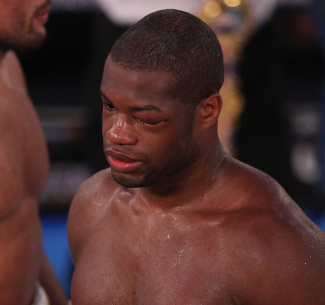 , Anthony Joshua defends Daniel Dubois after Brit was accused of ‘quitting’ against Joe Joyce
