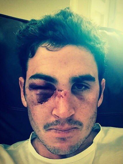 , How Cricket World Cup winner Craig Kieswetter launched growing racing operation after career-ending eye injury