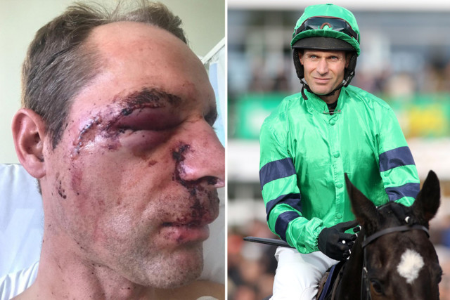 , Leading jockey Danny Cook could be forced to retire over fears of losing eyesight after horror face injury