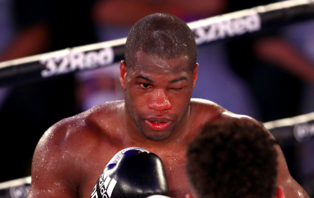 , Daniel Dubois given all-clear to return to boxing after horror cracked eye socket and will make ring comeback in May