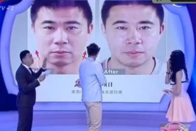 However, a spectacular fall from grace culminated in Fangzhuo appearing on a Chinese reality TV show undergoing plastic surgery