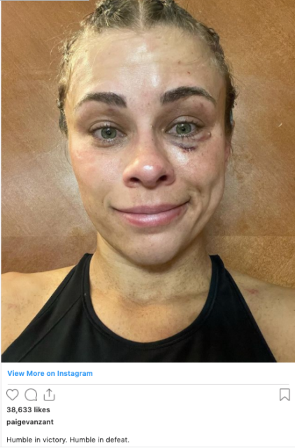 , Paige VanZant shows off bruised face after brutal bare-knuckle debut but ex-UFC star left ‘humble in victory or defeat’
