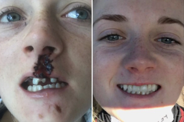 , Racing’s unluckiest injuries including the jockey who was run over by an ambulance and Hollie Doyle smashing her teeth