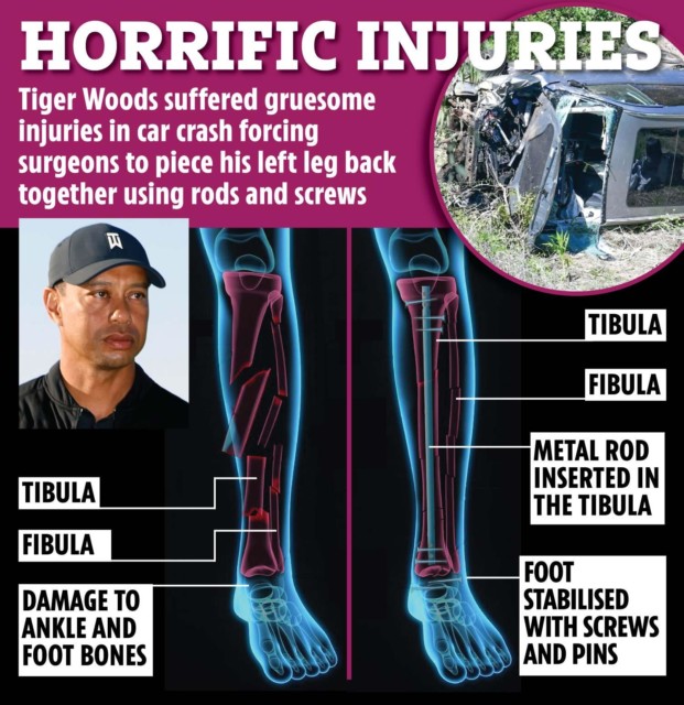 , Tiger Woods ‘tears up golf course in garden of his £40m mansion as he battles back from career-threatening crash injury’