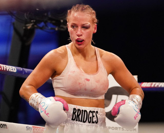 , Ebanie Bridges offers support to Billy Joe Saunders after initially questioning extent of eye injury after Canelo loss