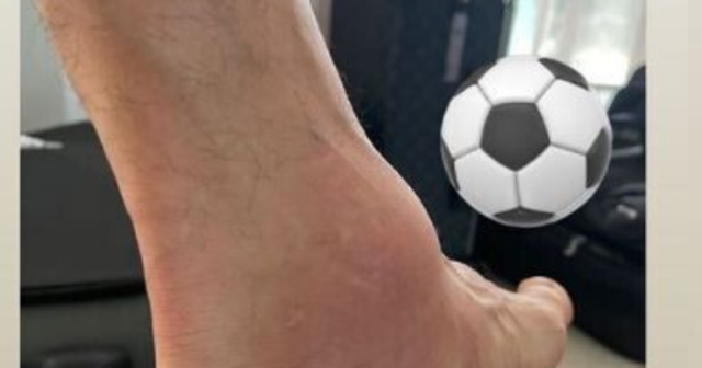 , Angel Di Maria played on in Copa America final with horror swollen ankle after suffering injury in first half