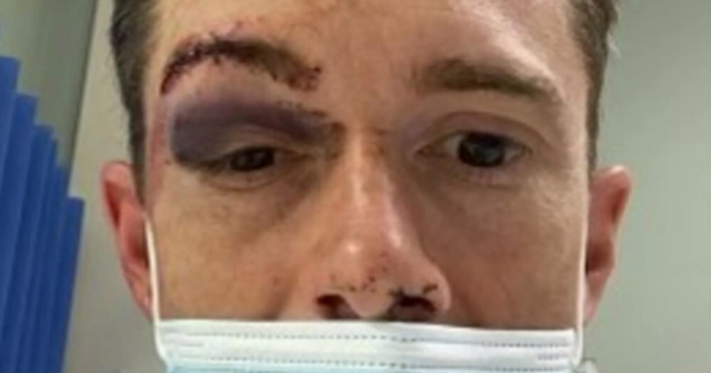 , Jockey’s goggles ‘filled with blood’ and he looked ‘hideous’ after freak horseshoe smash