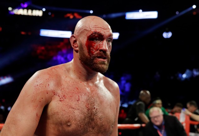 , Dillian Whyte to face Otto Wallin – who forced Tyson Fury to have 47 stitches – in blockbuster O2 fight on October 30