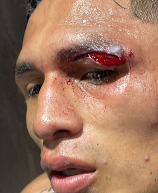 , Leeds star Luke Ayling filmed launching X-rated rant after Josh Warrington fight ends in frustrating draw over headbutt
