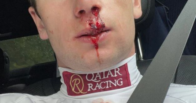 , Oisin Murphy posts selfie of bloodied and battered face amid jockey title fight with William Buick