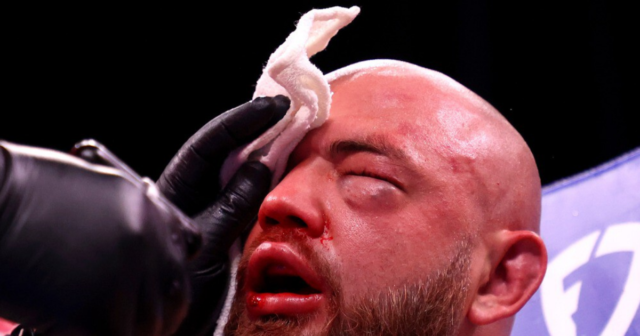 , Heavyweight star Adam Kownacki banned from blowing his NOSE after fracturing skull during loss on Fury vs Wilder card