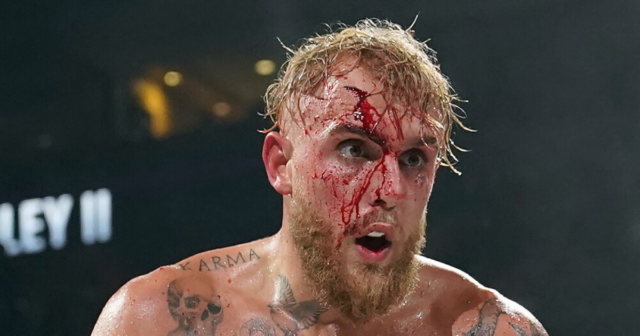 , Logan Paul shows off brother Jake’s gruesome gash suffered in rematch win against ex-UFC champ Tyron Woodley