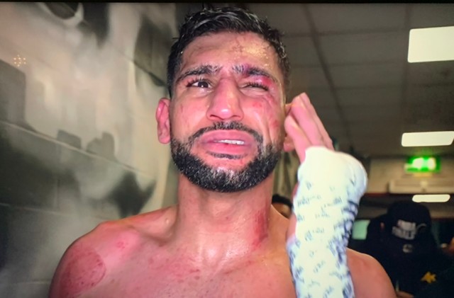 , Amir Khan’s face looks battered and bruised after his brutal defeat to rival Kell Brook