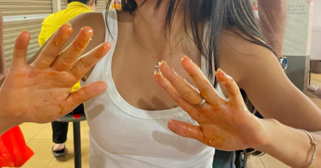 , Emma Raducanu shares first picture of nasty blister that ruined her Australian Open campaign during break in Singapore