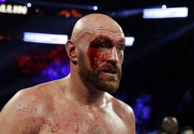 , Otto Wallin calls out Anthony Joshua if Usyk delays rematch… but fears giving Tyson Fury 47 stitches may scare him off