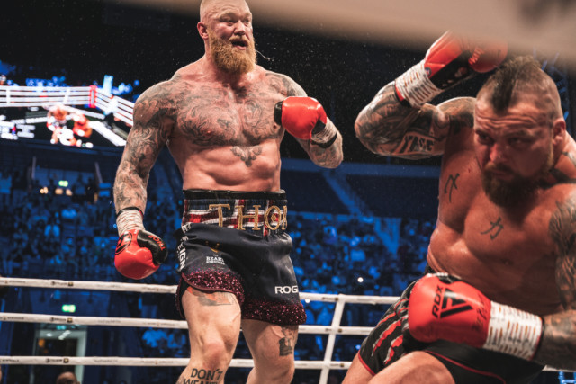 , Thor Bjornsson shows off brutal black eye as scars from war with Eddie Hall are revealed after Games of Thrones ace wins