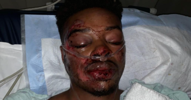 , Errol Spence Jr has ‘a second chance in life’ and third in boxing after life-threatening car crash and horror eye injury