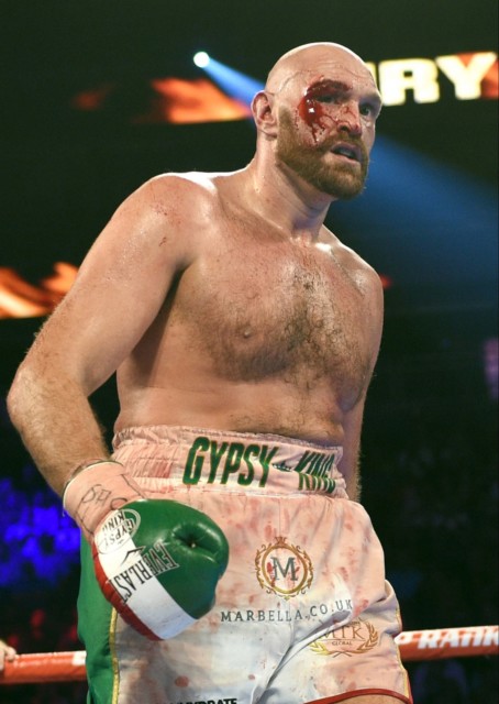 , Tyson Fury’s hardest fights, from McDermott ‘robbery’, to 47 stitches against Wallin and dropped by Cunningham