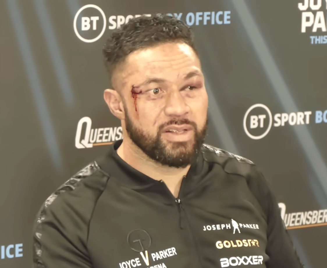 , Joseph Parker’s face looks battered and bruised after 11th round Joe Joyce KO as Kiwi says ‘he’s a hell of a fighter