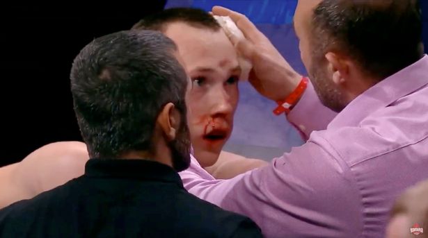 , Kickboxer Danil Sharov suffers horrific fractured skull after being kneed in head but amazingly tries to carry on