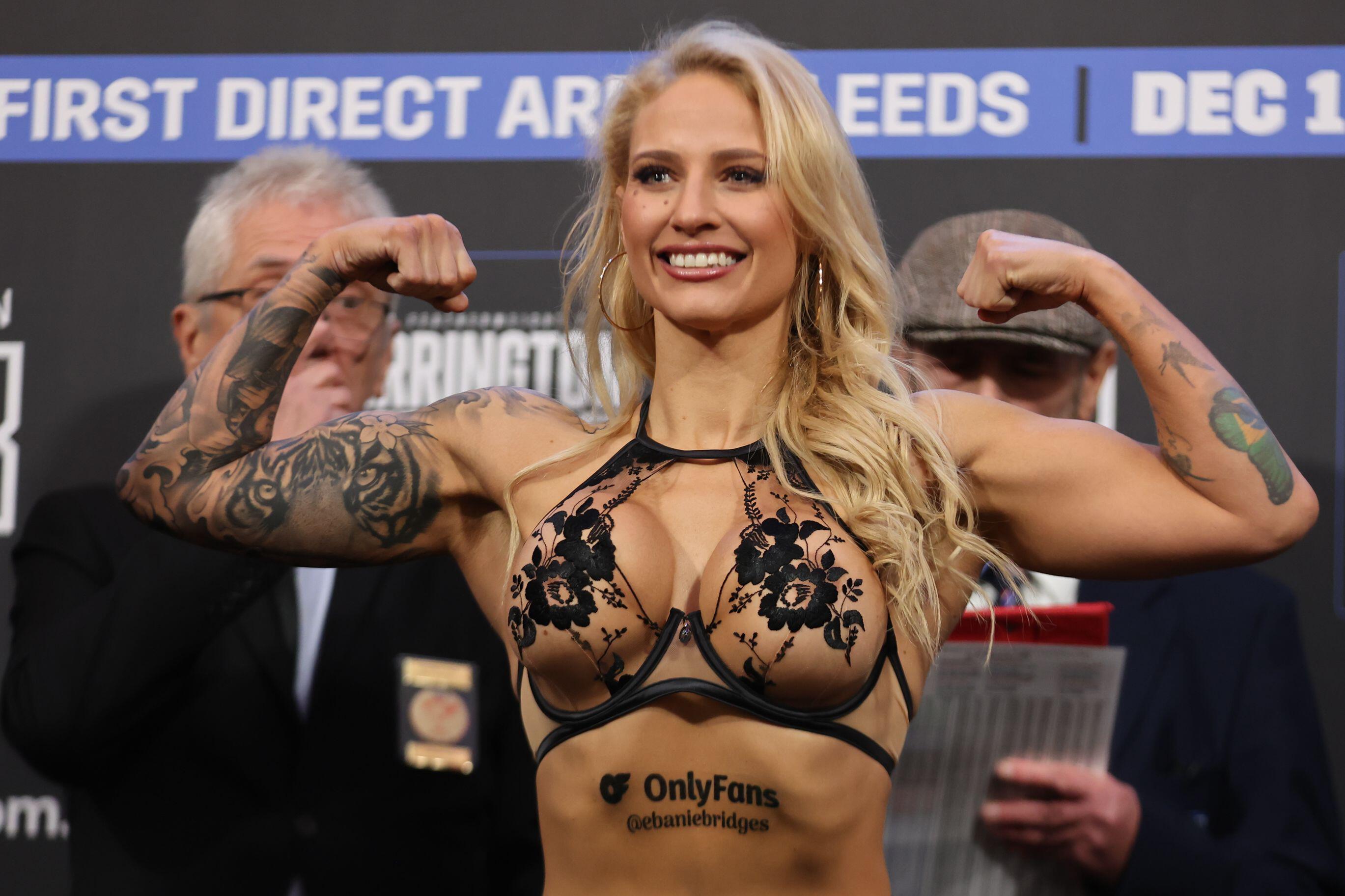 , Ebanie Bridges shares gruesome pictures of her hand surgery after breaking bone in build-up to Shannon O’Connell fight