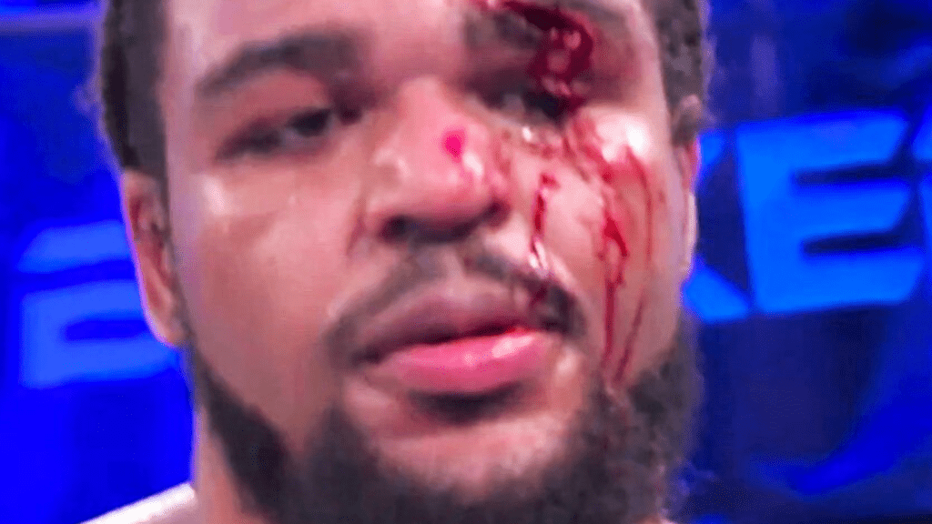 , Brit boxing up-and-comer Jamie TKV left covered in blood with gruesome eye injury in brutal shock loss to late stand-in