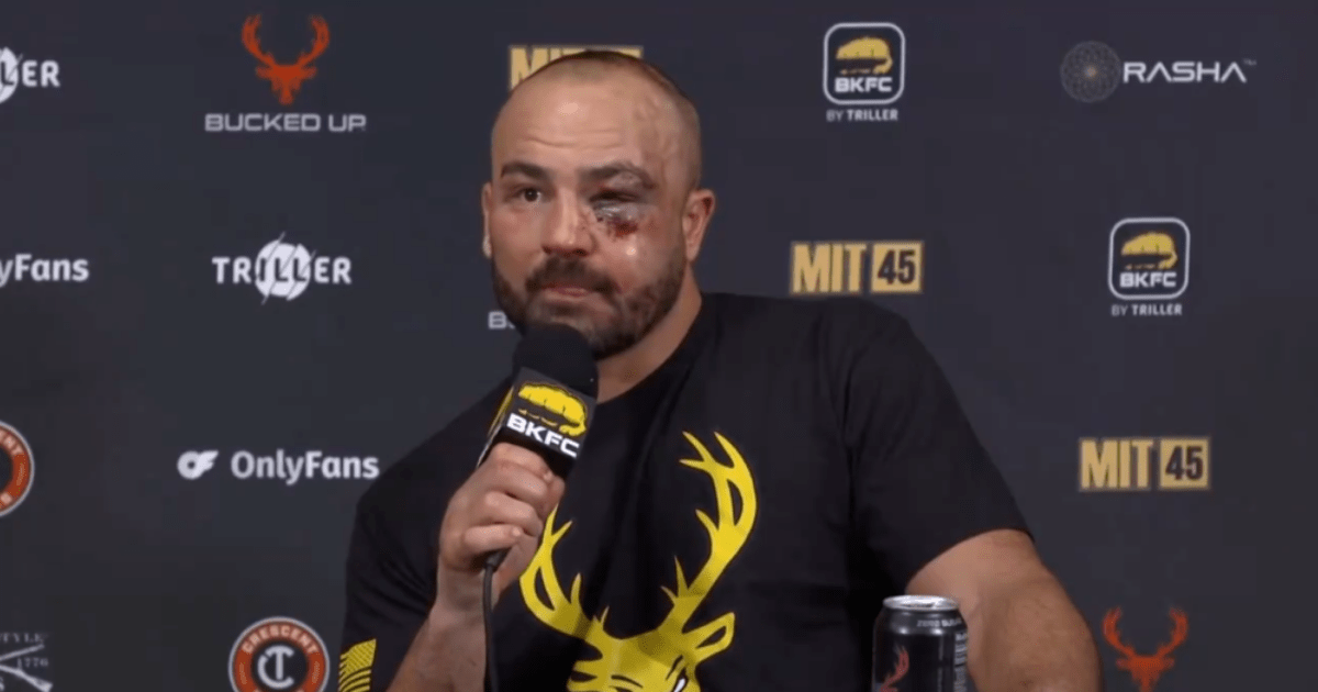 , Former UFC Champion Eddie Alvarez Suffers Horror Facial Injuries in Bare-Knuckle Boxing Defeat